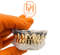 Solid Gold Grillz